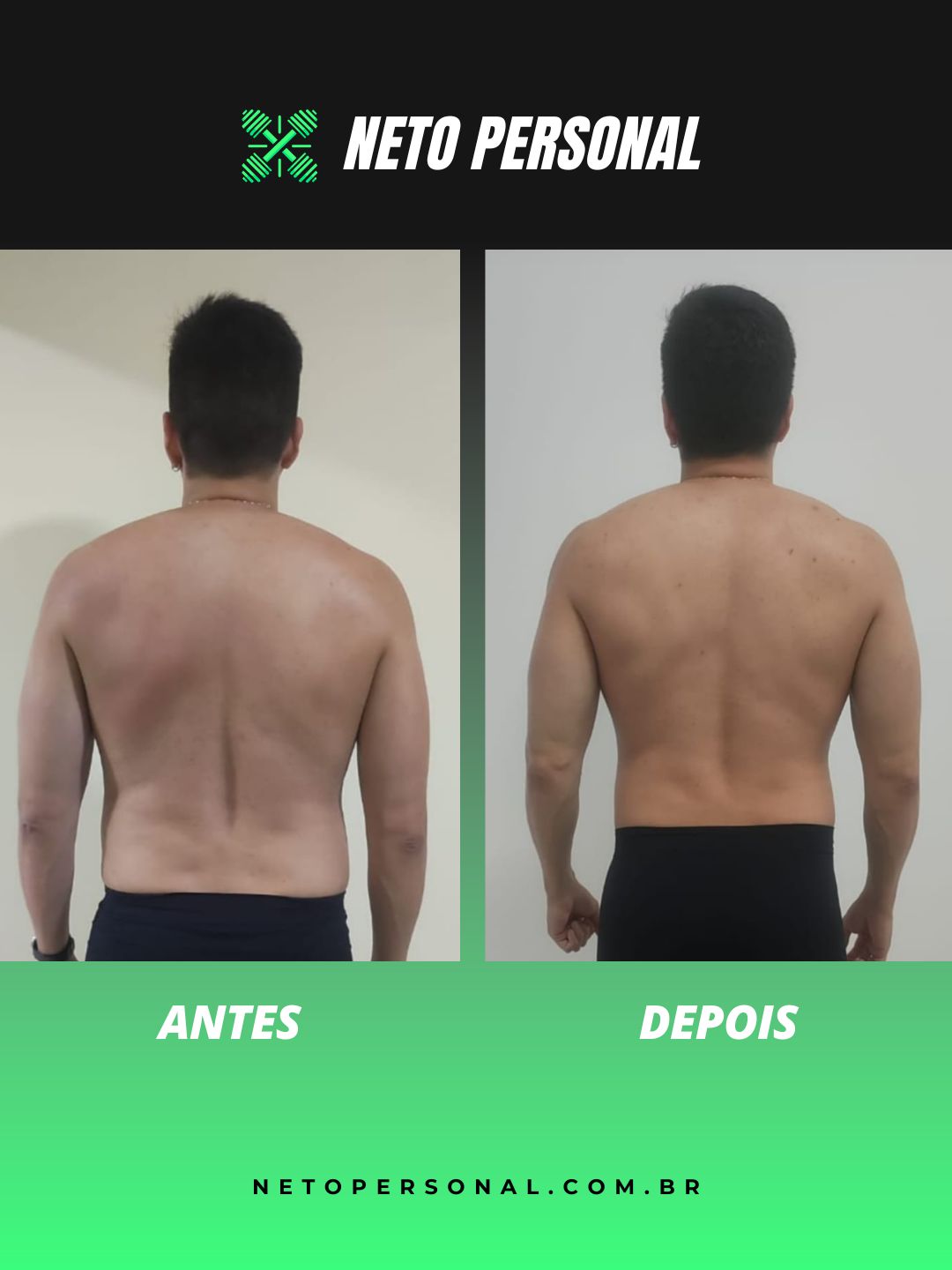 Resultado aluna - Antes e Depois Personal Trainer Online